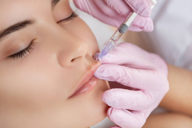 Dermal Filler